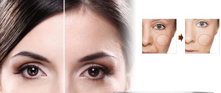 baebody retinol moisturizer cream